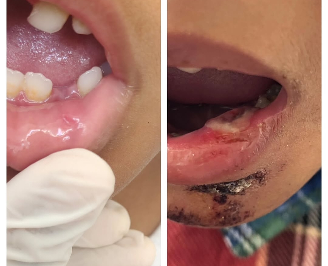 Successful homoeopathic treatment