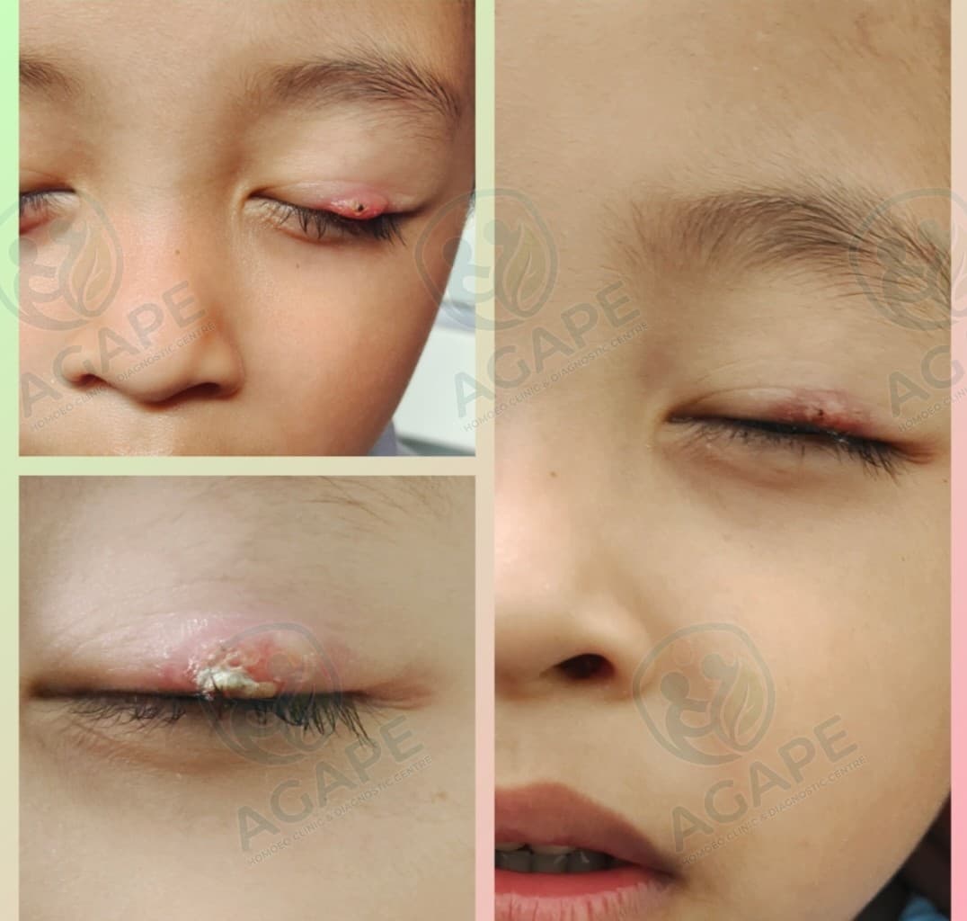 Patient treatment case